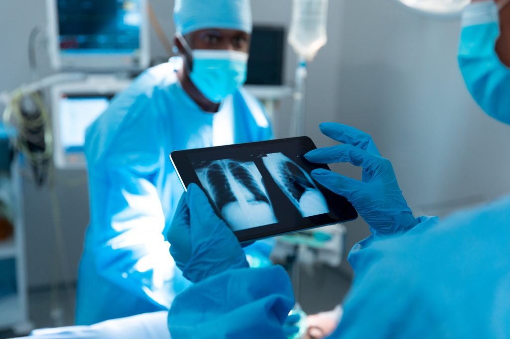 Doctor wearing surgical gloves looking at lung x-ray on tablet