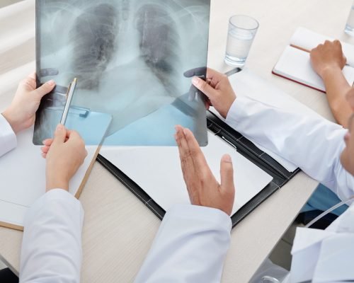 Doctors discussing x-ray